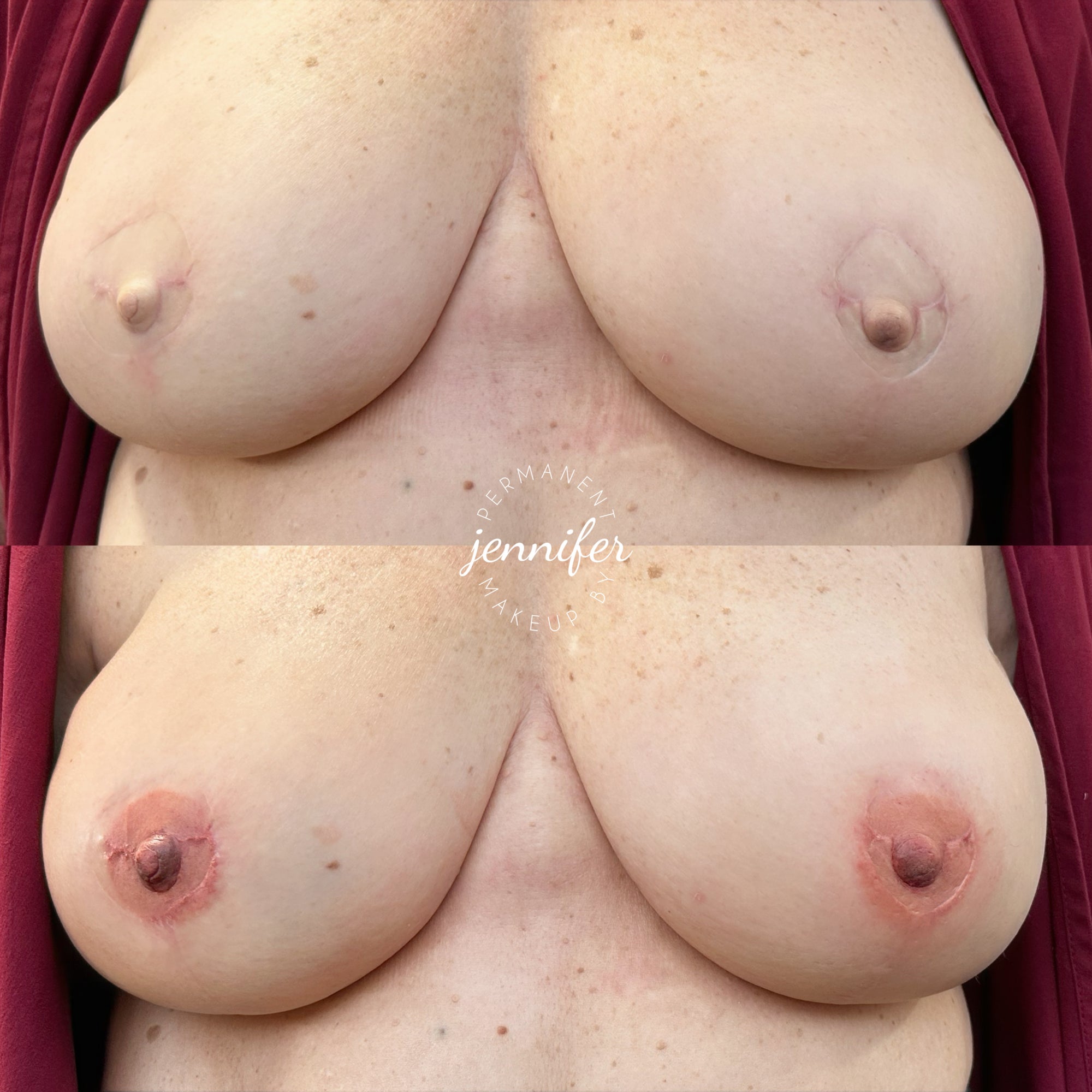 Areola Tattoo Consultation